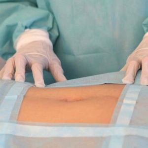 Комплект белья одноразовый общехирургический КООП-02 ГЕКСА стерильный, 6 предметов